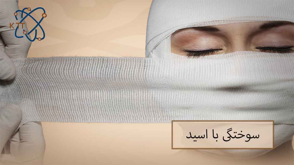 ترمیم صورت سوخته با اسید