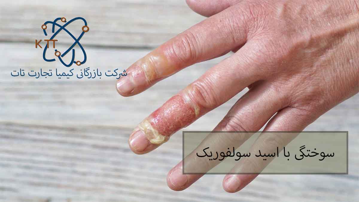 عوارض سوختگی با سولفوریک اسید و کمکهای اولیه