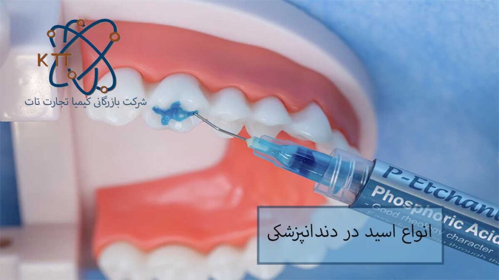 پرکاربردترین انواع اسید در دندانپزشکی